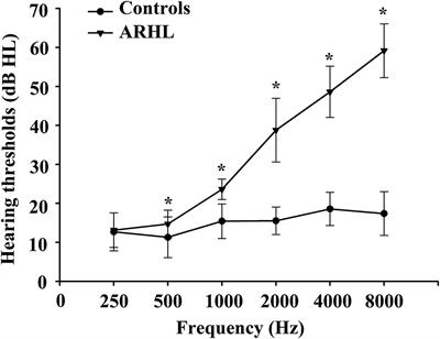 Aberrant brain functional network strength related to cognitive impairment in age-related hearing loss